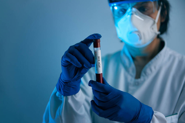 Coronavirus 2019-nCoV Blood Sample. Doctor scientist in protective gloves, mask and glasses holding test tube with blood for 2019-nCoV analyzing. Coronavirus blood test Concept. Vaccine research - Foto, afbeelding