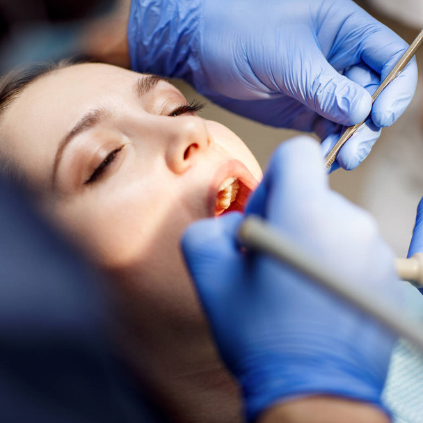 Dentist treating teeth to young woman patient in clinic. - Photo, Image