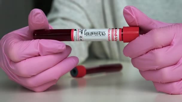Positive And Negative Covid-19 Test And Laboratory Sample Of Blood - Filmagem, Vídeo