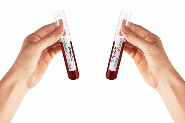 Coronavirus Covid 19 blood sample in sample tube in hand, isolated on white - Foto, Bild
