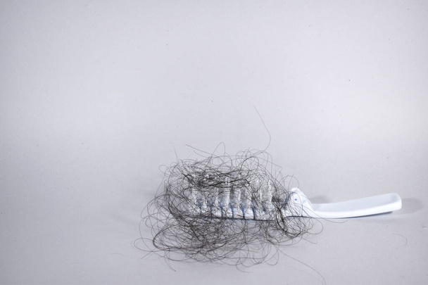 Problemas de pérdida de cabello son muchos
 - Foto, imagen