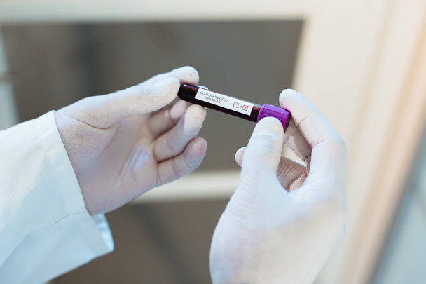 Врач-вирусолог осматривает образец анализа крови с подозрением на вирус Ковида-19
. - Фото, изображение
