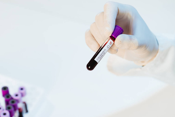 A virologist doctor is examining a sample of a blood test with suspected Covid-19 virus. - Foto, imagen