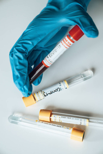 Test COVID-19 et échantillon de laboratoire de tests sanguins pour le diagnostic de la nouvelle infection par le virus Corona de Wuhan avec des antécédents hospitaliers. Concept infectieux pandémique
 - Photo, image