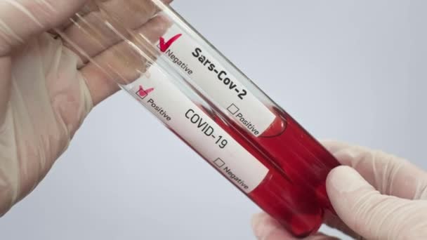 A virologist holds in her hands two test tubes with a blood sample infected with a coronovirus. Controversial unknown result. Test for COVID-19 virus. Laboratory studies of bacteriological weapons - Materiał filmowy, wideo