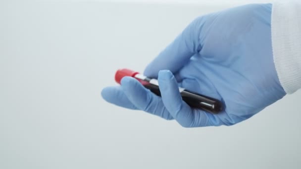 Az orvos kesztyűt viselő kezében cső minta, vérvizsgálat. COVID-19 diagnosztika - Felvétel, videó