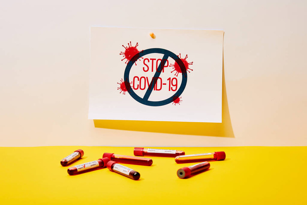 papel con letras stop covid-19 cerca de los tubos de ensayo con muestras de sangre en blanco y amarillo
 - Foto, Imagen