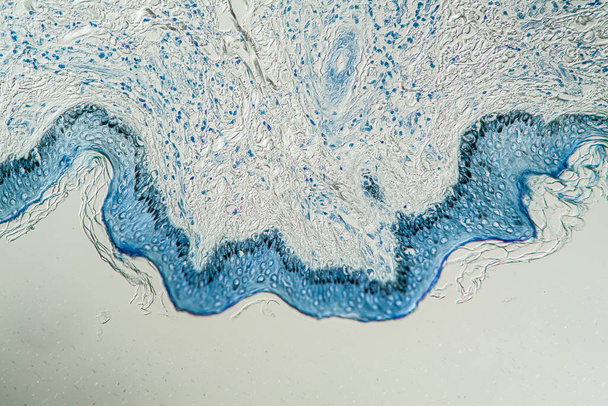Leprosy skin under the microscope 200x - Photo, Image
