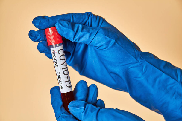 Kädet pitävät koeputkea, joka sisältää verinäytteen, koeputkea, jossa on verta Covid-19-analyysiä varten beige-taustalla. Laboratoriokokeet potilaiden verta. Käsitteellinen kuva
. - Valokuva, kuva