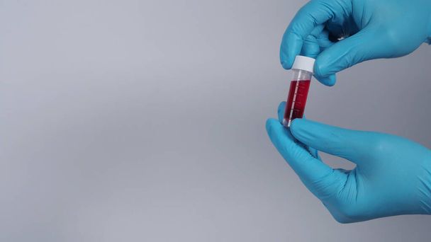 Análisis de sangre en tubo transparente en manos del médico con guantes médicos azules y traje PPE que representan coronavirus o prueba de detección pandémica 2019-ncov o covid-19 que da resultados positivos o infectados
  - Foto, Imagen