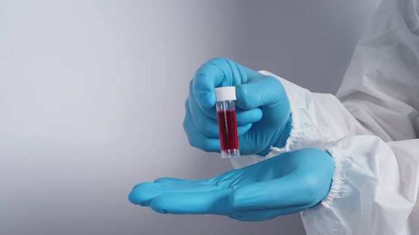 Bluttests im Klarglas an Arzthänden mit blauen medizinischen Handschuhen und PSA-Anzug, die Coronavirus oder 2019-ncov oder covid-19 Pandemie-Screening-Test darstellen, dass positive Ergebnisse oder infizierte  - Foto, Bild
