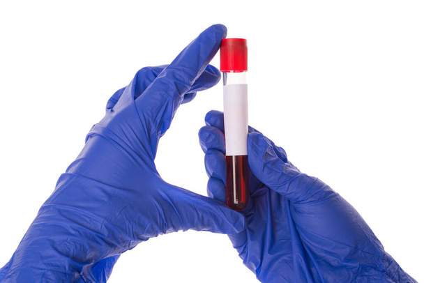 Foto de cerca de las manos sosteniendo el tubo de ensayo con líquido rojo aislado sobre fondo blanco
 - Foto, Imagen