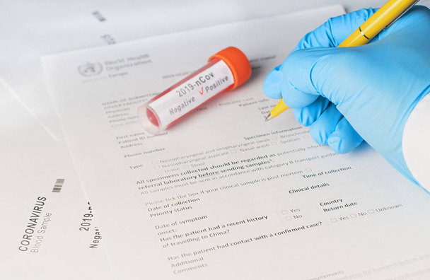 Šíření koronaviru je dokumentováno lékařem po pozitivním testu - Fotografie, Obrázek