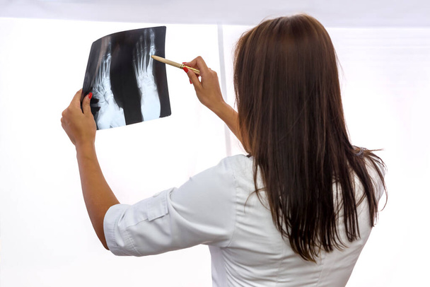 Doctor with x-ray isolated on white. Woman holding patient's x-ray and examining it - Foto, Imagem