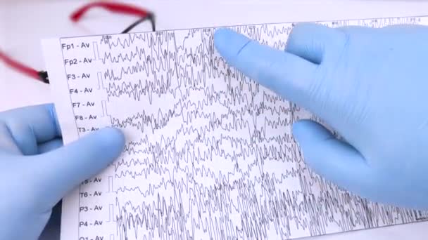 A neurologist examines an encephalogram of a patients brain. Schedule of electroencephalograms, study of brain currents for signs of epilepsy and pathologies of the nervous system - Footage, Video