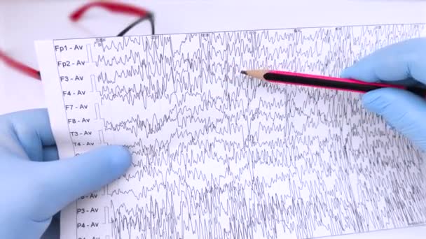 Ένας νευρολόγος εξετάζει ένα εγκεφαλογράφημα ενός εγκεφάλου ασθενών. Πίνακας ηλεκτροεγκεφαλογραφημάτων, μελέτη εγκεφαλικών ρευμάτων για σημεία επιληψίας και παθολογιών του νευρικού συστήματος - Πλάνα, βίντεο