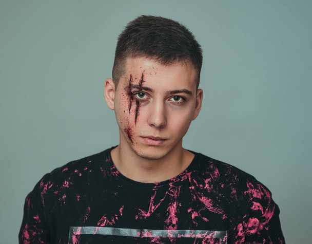 Um adolescente com feridas na cara. Bullying e assédio
. - Foto, Imagem