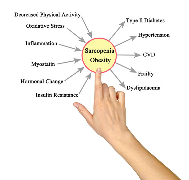  Causas e consequências da sarcopenia Obesidade
 - Foto, Imagem