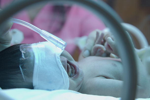 incuba ultraviyole lambası altında oxyzen ile Prematüre bebek - Fotoğraf, Görsel