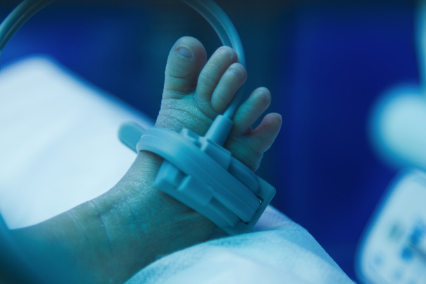 πρόωρη πόδι του μωρού κάτω από υπεριώδη λάμπα στην θερμοκοιτίδα - Φωτογραφία, εικόνα