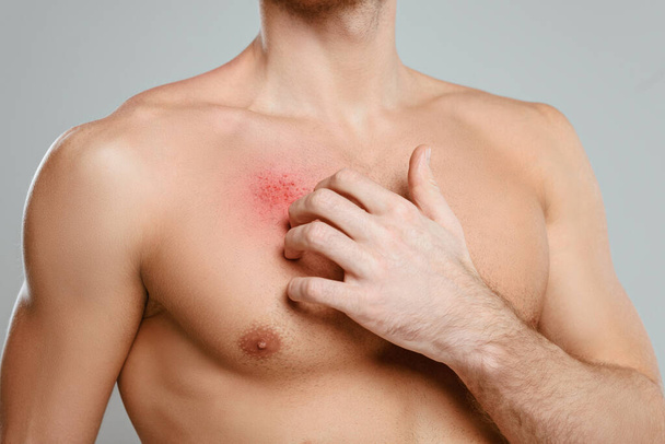Részleges kilátás az ember kaparás bőr allergia izolált szürke - Fotó, kép