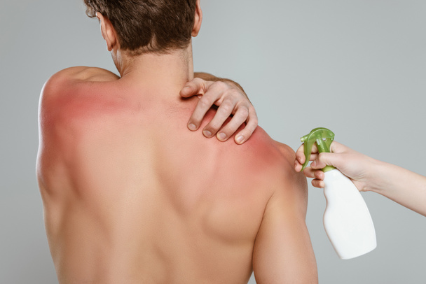 Cropped view of woman with bottle of spray near man touching skin with sunburn isolated on grey - Photo, Image