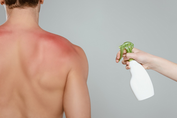 Vista recortada da mulher aplicando spray nas costas masculinas com vermelhidão isolada no cinza
 - Foto, Imagem