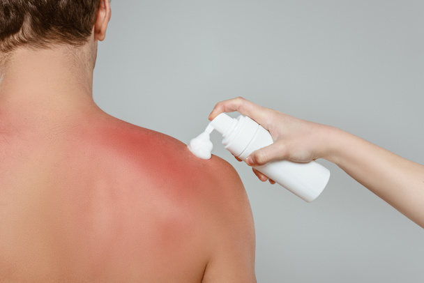 Vista recortada de la mujer aplicando espuma en la espalda masculina con quemaduras solares aisladas en gris
 - Foto, Imagen