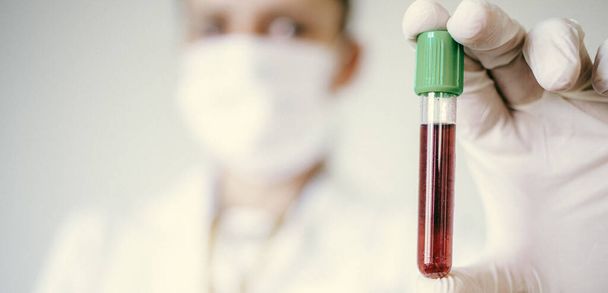 female doctor holding a blood test sample coronavirus - Φωτογραφία, εικόνα