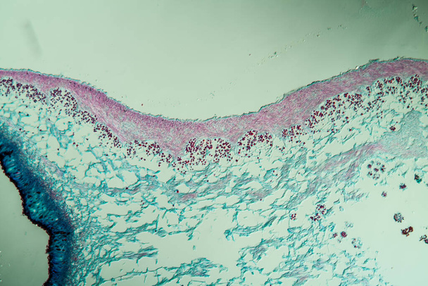 Coupe transversale à travers le corps du symbiote de lichen 100x
 - Photo, image