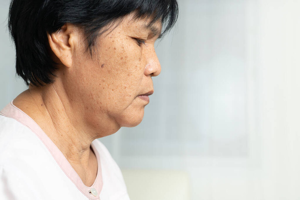 Close-up do rosto da mulher idosa asiática com condição de pele enrugada. vista lateral
 - Foto, Imagem