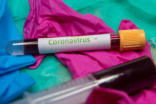 Tube avec sang et test négatif au coronavirus
.. - Photo, image