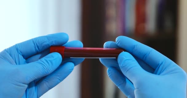 Doctor Holding Pandemic Coronavirus 2019-nCoV Blood Minta Pozitív Test Tube. Orvos visel orvosi maszk és kesztyű, és azt mutatja, a beteg vérvizsgálati cső tartalmazó corona vírus (COVID-19) - Felvétel, videó