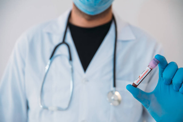 Doctor Holding Pandemic Coronavirus 2019-nCoV Blood Sample Positive Test Tube. Médico con máscara médica y guantes y muestra el tubo de análisis de sangre del paciente que contiene el virus de la corona (COVID-19
) - Foto, imagen