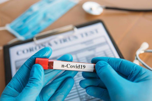 Doctor Holding Pandemic Coronavirus 2019-nCoV Blood Sample Positive Test Tube. Doctor wearing medical mask and gloves and shows patient's blood test tube containing corona virus (COVID-19) - Фото, изображение