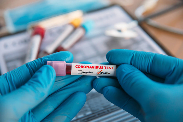 Doctor Holding Pandemic Coronavirus 2019-nCoV Blood Sample Positive Test Tube. Doctor wearing medical mask and gloves and shows patient's blood test tube containing corona virus (COVID-19) - Photo, Image