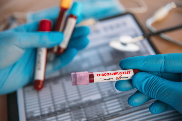 Doctor Holding Pandemic Coronavirus 2019-nCoV Blood Sample Positive Test Tube. Médico con máscara médica y guantes y muestra el tubo de análisis de sangre del paciente que contiene el virus de la corona (COVID-19
) - Foto, Imagen