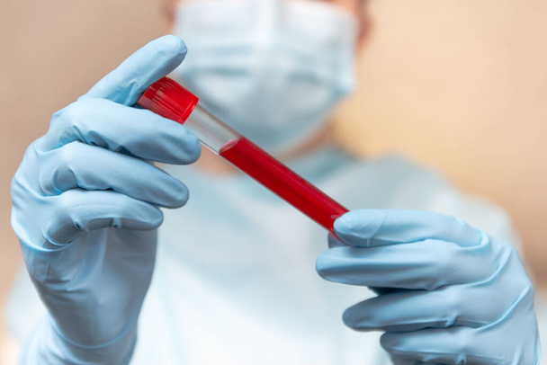 Coronavirus kan testi. Koruyucu giysili doktor, tıbbi maske ve lateks eldivenler içinde kan olan bir tüp tutuyor..  - Fotoğraf, Görsel