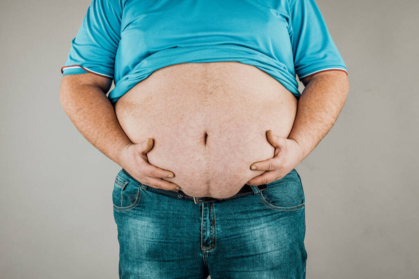 Elleri karnına dokunan bir kişinin aşırı kilolu vücudu. Obezite kavramı. - Fotoğraf, Görsel