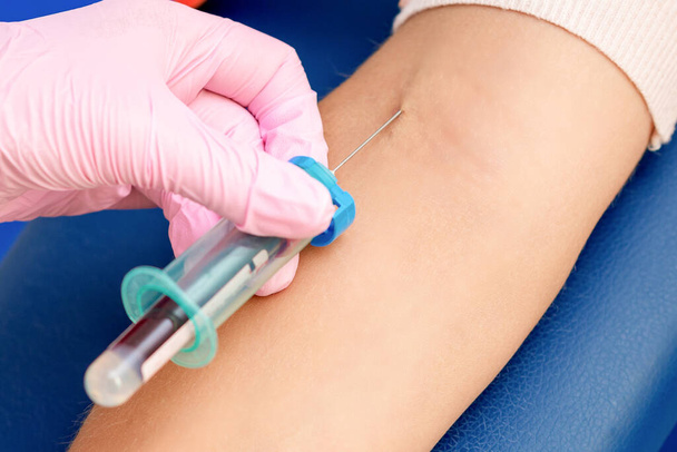 Nurse takes blood sampling introducing a needle into a vein of woman's arm. - Foto, afbeelding