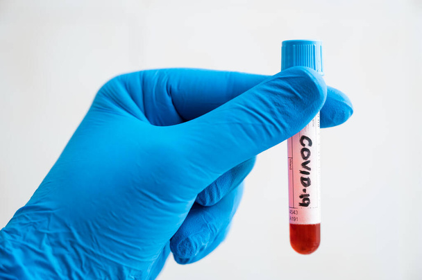 A hand of nurse with blue glove holding sample tube with blood for coronavirus COVID-19 test - Photo, Image
