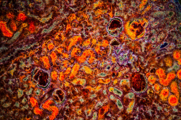 Ledvinová tkáň s ledvinovými krvinkami s krvácením 100x - Fotografie, Obrázek