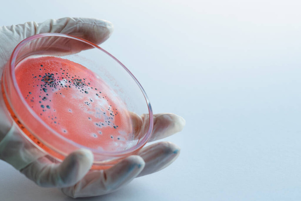 Research of viruses and bacteria, researcher holds a Petri dish with a sample. - Φωτογραφία, εικόνα
