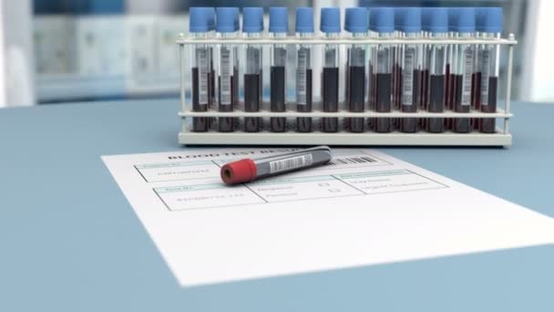 Medizinischer Bluttest ist negativ für Virusnachweis - Filmmaterial, Video
