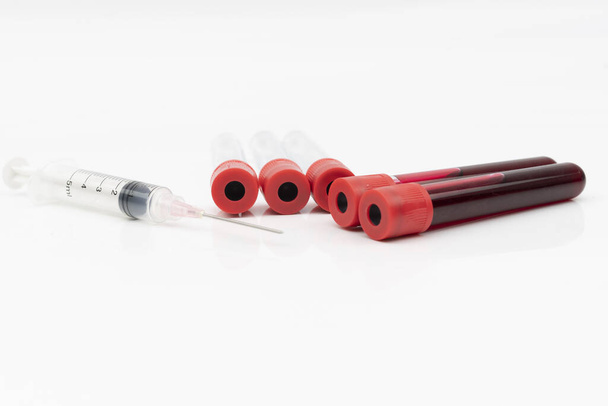 Equipamento médico contém seringa e tubo de teste de plástico com amostra de sangue para teste laboratorial isolado na focagem branca e seletiva
 - Foto, Imagem