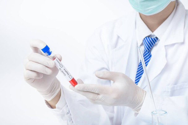 laboratory assistant hand is holding blood test infected Covid-19 - Фото, зображення