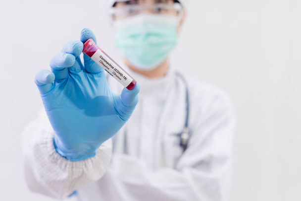 Laboratory testing patients blood samples for presence of coronavirus (COVID-19). The doctor holds a test tube containing a blood sample that has no the result positive or negative for coronavirus. - Photo, Image
