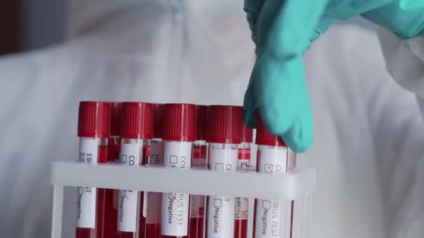 Testbuis met bloed voor analyse op coronavirus. - Video