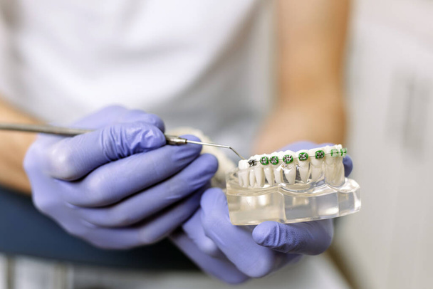 El dentista muestra un modelo artificial de la mandíbula con aparatos ortopédicos. Cómo cuidar adecuadamente la cavidad oral, poner frenos, costo y consecuencias
. - Foto, imagen