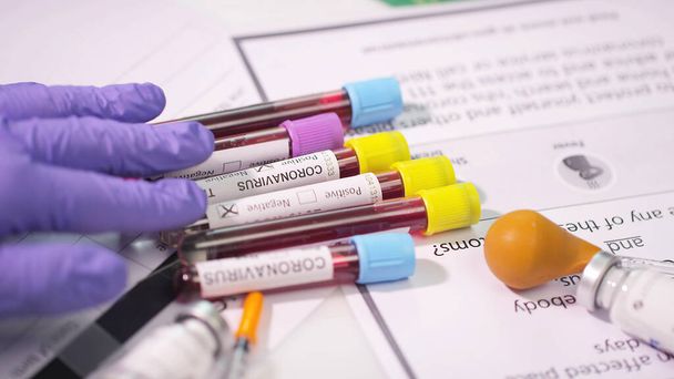 close-up of Covid Test blood samples in test tubes - Foto, Imagen